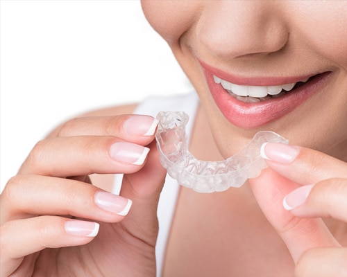 Clear Aligner Braces
